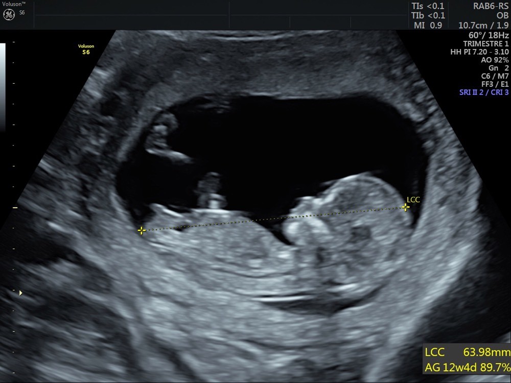 Avis Sexe Bebe Echographie Connaitre Le Sexe De Votre Bebe Forum Grossesse Amp Bebe Doctissimo Avis Sexe Bebe Echographie Connaitre Le Sexe De Votre Bebe Forum Grossesse Amp Bebe Doctissimo