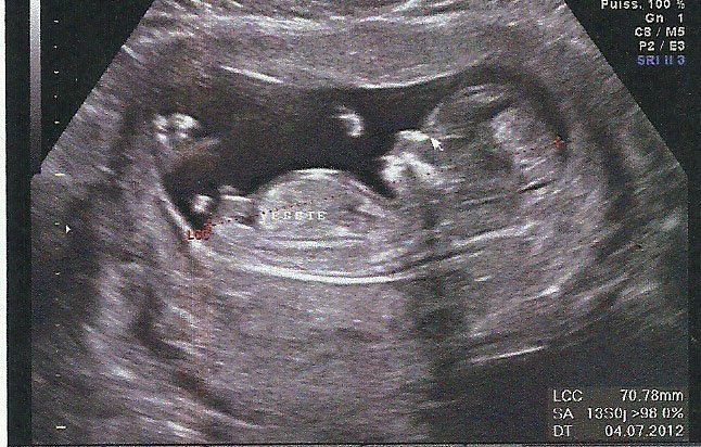 Le Plus Prefere Taille Bebe 13sa Taille Bebe 13 Sa Imagesgratuitesldo