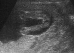 Comparaison Sa Y Est Les Filles J Ai Le Verdict Echographie Connaitre Le Sexe De Votre Bebe Forum Grossesse Amp Bebe Doctissimo Comparaison Sa Y Est Les Filles J Ai Le Verdict Echographie Connaitre Le Sexe De Votre Bebe Forum Grossesse Amp Bebe Doctissimo