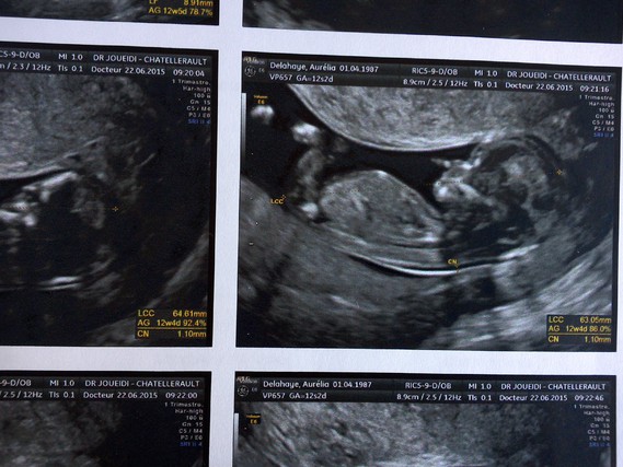 Faire Part Grossesse Etoile Filante Photos Club Doctissimo Faire Part Grossesse Etoile Filante Photos Club Doctissimo