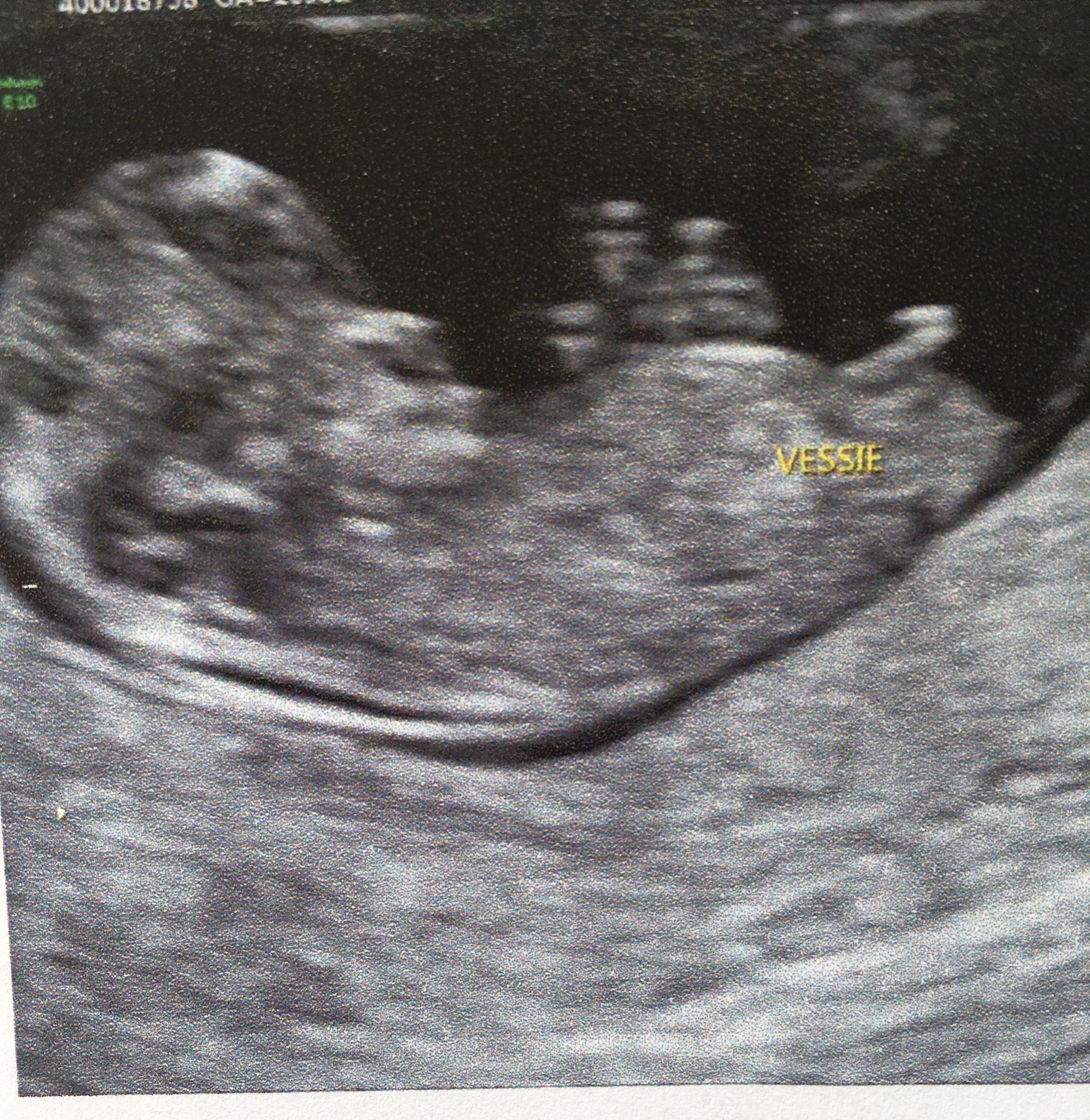 Pour Toutes Celles Qui Psychotent Sur Le Tubercule De Leur Bebe Echographie Connaitre Le Sexe De Votre Bebe Forum Grossesse Amp Bebe Doctissimo Pour Toutes Celles Qui Psychotent Sur Le Tubercule De Leur Bebe Echographie Connaitre Le Sexe De Votre Bebe Forum Grossesse Amp Bebe Doctissimo