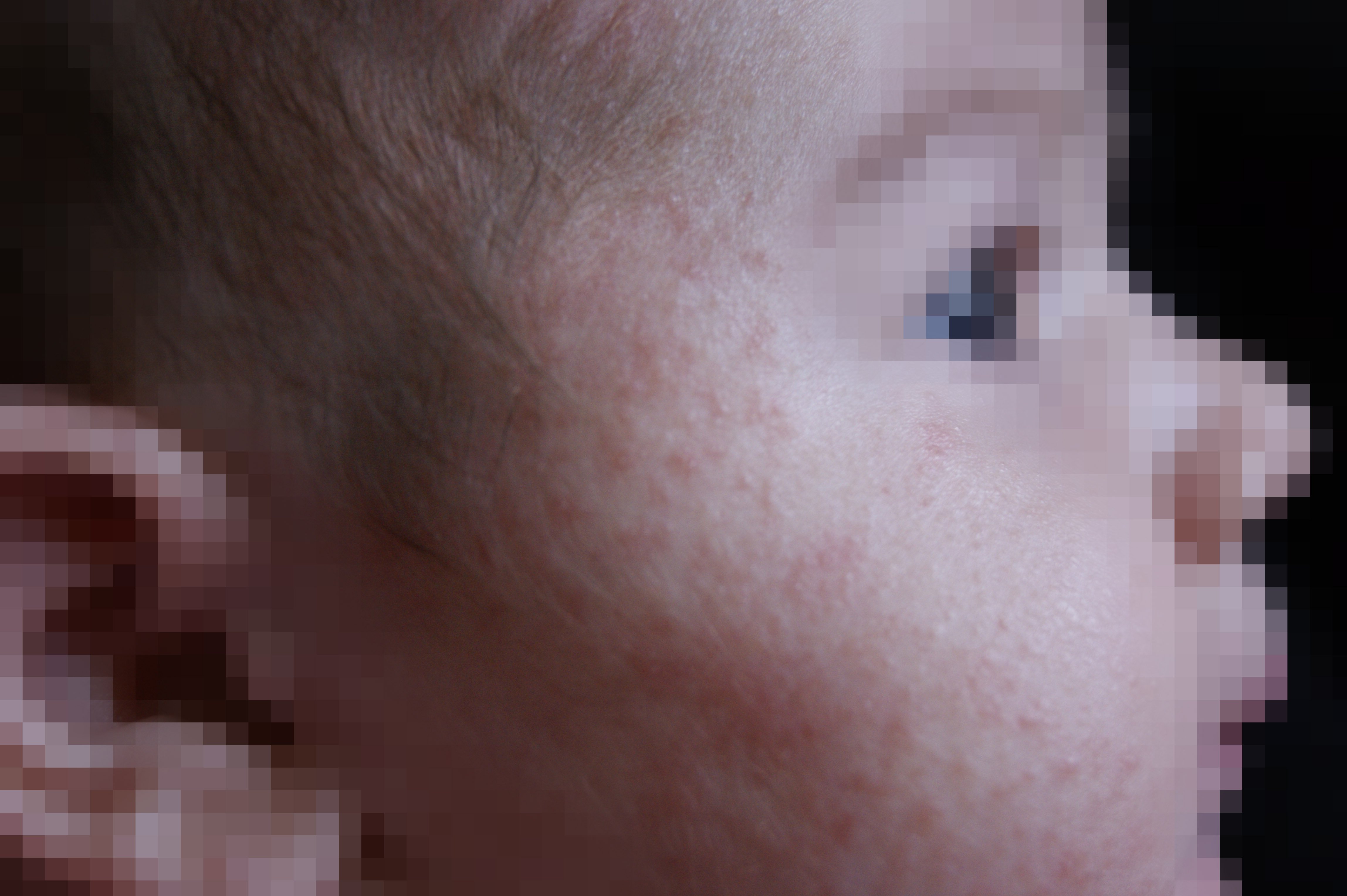 Plaques Rouges Sur Bebe Allergies Et Eczema Forum Sante Doctissimo Plaques Rouges Sur Bebe Allergies Et Eczema Forum Sante Doctissimo