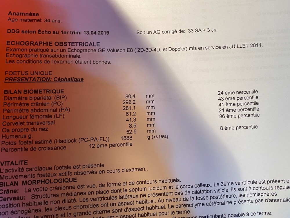 Humerus Trop Court A 33sa Help Amniocentese Forum Grossesse Amp Bebe Doctissimo Humerus Trop Court A 33sa Help Amniocentese Forum Grossesse Amp Bebe Doctissimo