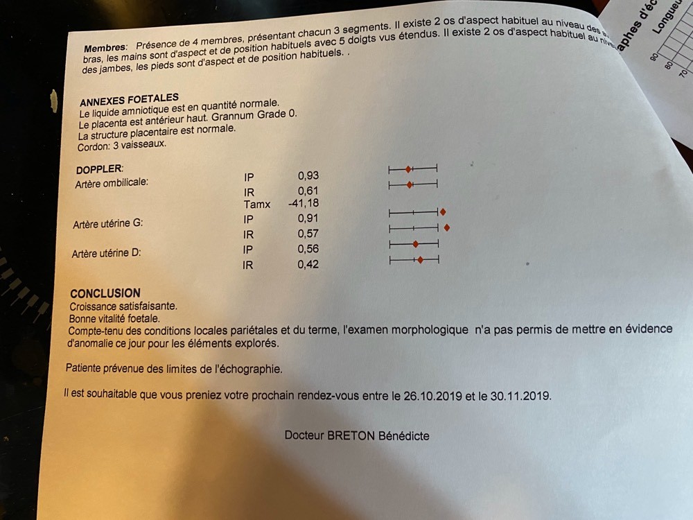 Humerus Trop Court A 33sa Help Amniocentese Forum Grossesse Amp Bebe Doctissimo Humerus Trop Court A 33sa Help Amniocentese Forum Grossesse Amp Bebe Doctissimo