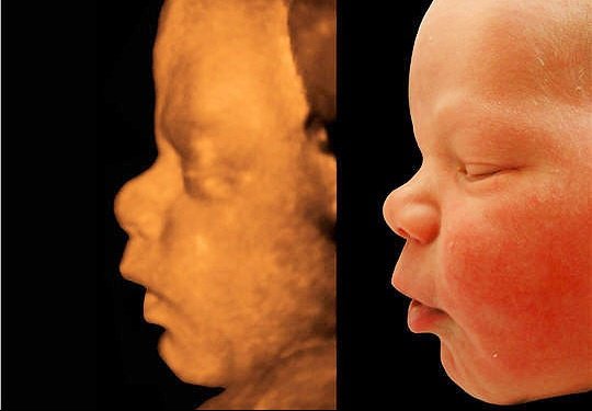 Echographie 3d A La Rochelle Grossesse Forum Grossesse Amp Bebe Doctissimo