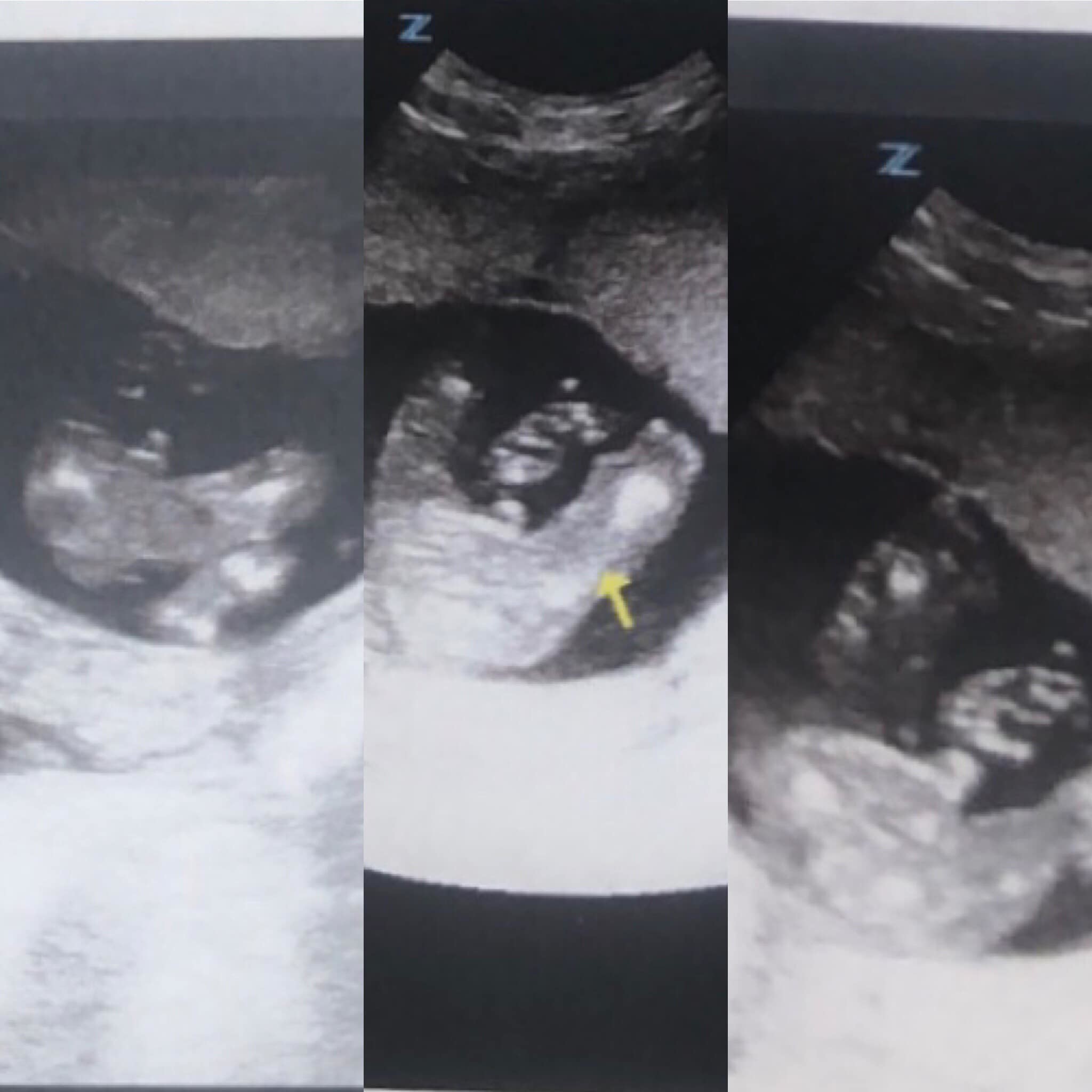 Avis Echo 16sa 2 Gros Doutes Echographie Connaitre Le Sexe De Votre Bebe Forum Grossesse Amp Bebe Doctissimo Avis Echo 16sa 2 Gros Doutes Echographie Connaitre Le Sexe De Votre Bebe Forum Grossesse Amp Bebe Doctissimo