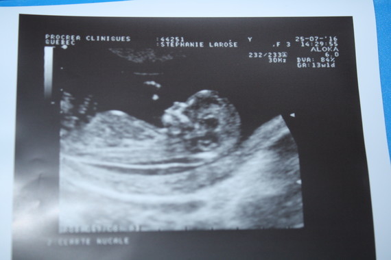 Clarte Nucale A 3 Mm Clarte Nucale A 3 Mm