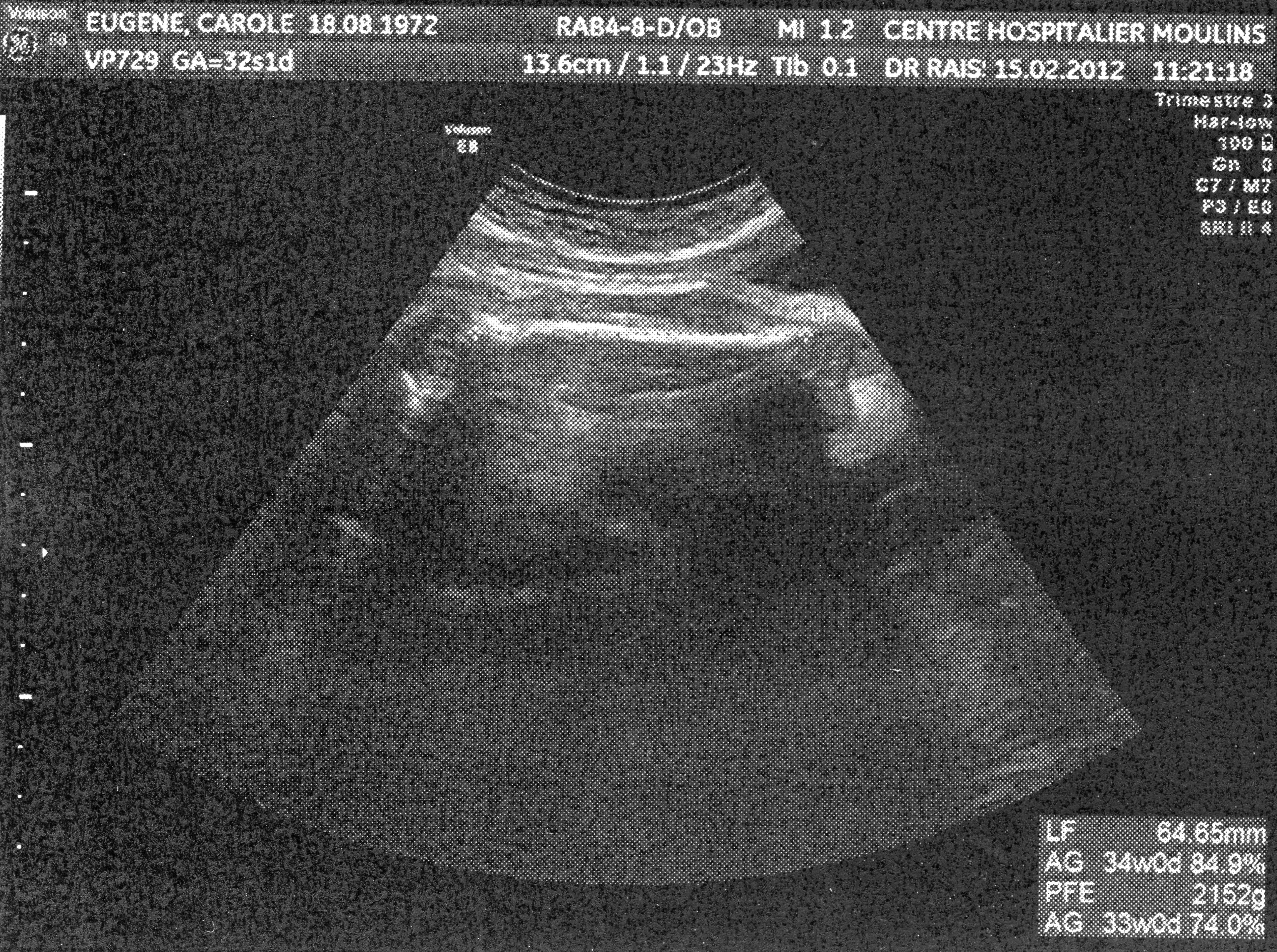 Avis Aux Expertes Echo Des 32 Sa Echographie Connaitre Le Sexe De Votre Bebe Forum Grossesse Amp Bebe Doctissimo Avis Aux Expertes Echo Des 32 Sa Echographie Connaitre Le Sexe De Votre Bebe Forum Grossesse Amp Bebe Doctissimo
