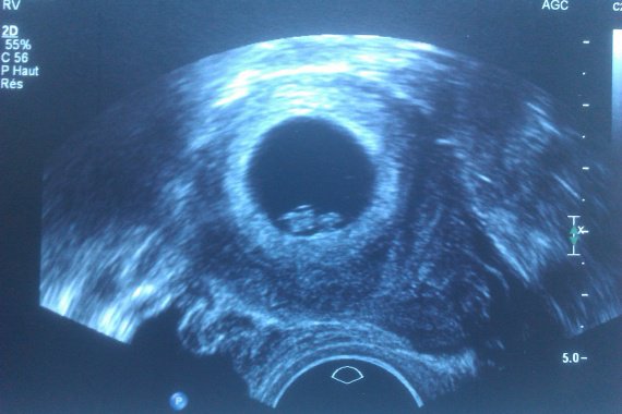 7 Sa Ma Grossesse Bebe 1 Lalaulautte Photos Club Doctissimo 7 Sa Ma Grossesse Bebe 1 Lalaulautte Photos Club Doctissimo