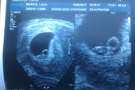 7 Sa Ma Grossesse Bebe 1 Lalaulautte Photos Club Doctissimo