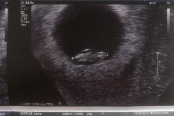 7 Sa Ma Grossesse Bebe 1 Lalaulautte Photos Club Doctissimo