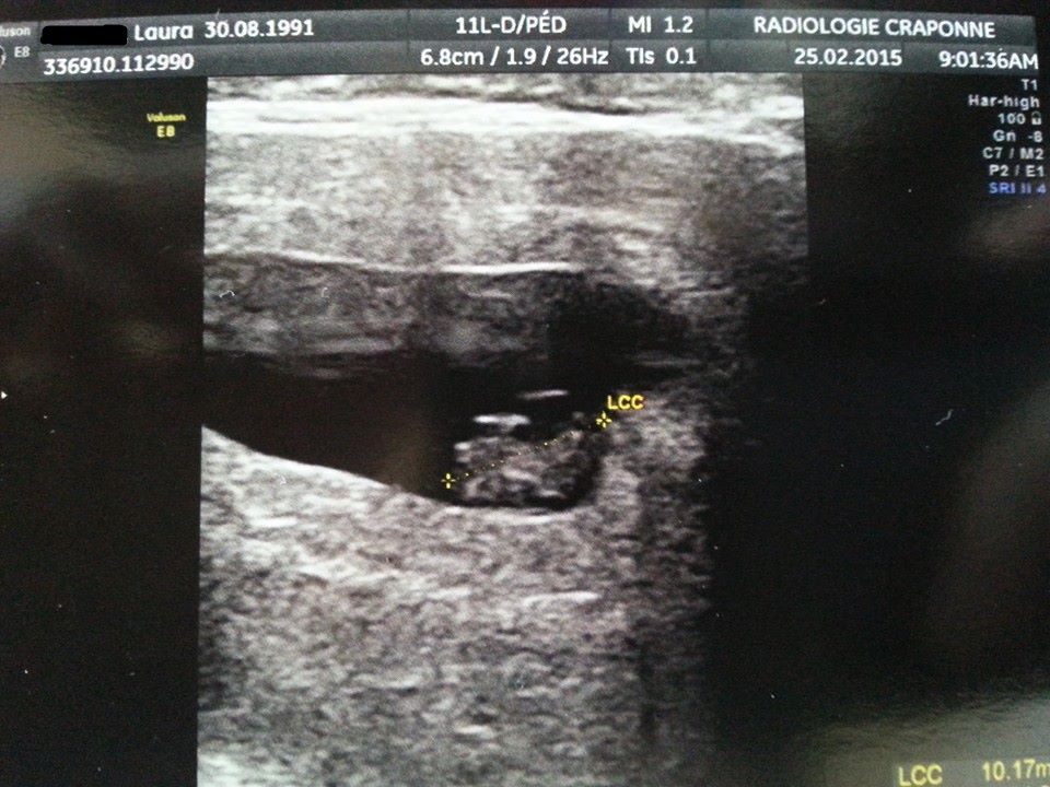 7sa 2 Bebe Fait 10mm Ma Grossesse Bebe 3 Lalaulautte Photos Club Doctissimo 7sa 2 Bebe Fait 10mm Ma Grossesse Bebe 3 Lalaulautte Photos Club Doctissimo