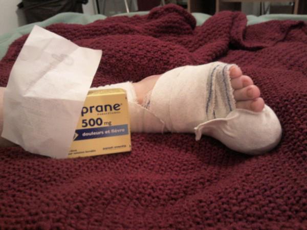 Operation Du Gros Orteil Incarne A 13 Ans Evolution Et Suivi Photos Sante De L Enfant Forum Sante Doctissimo Operation Du Gros Orteil Incarne A 13 Ans Evolution Et Suivi Photos Sante De L Enfant Forum Sante Doctissimo