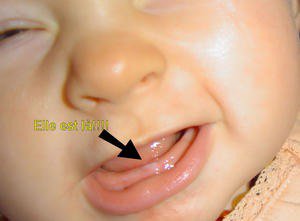 Les Dents Page 2 Bebe Grandit Forum Grossesse Amp Bebe Doctissimo Les Dents Page 2 Bebe Grandit Forum Grossesse Amp Bebe Doctissimo