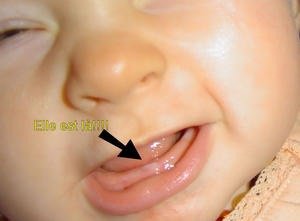Les Dents Page 2 Bebe Grandit Forum Grossesse Amp Bebe Doctissimo Les Dents Page 2 Bebe Grandit Forum Grossesse Amp Bebe Doctissimo