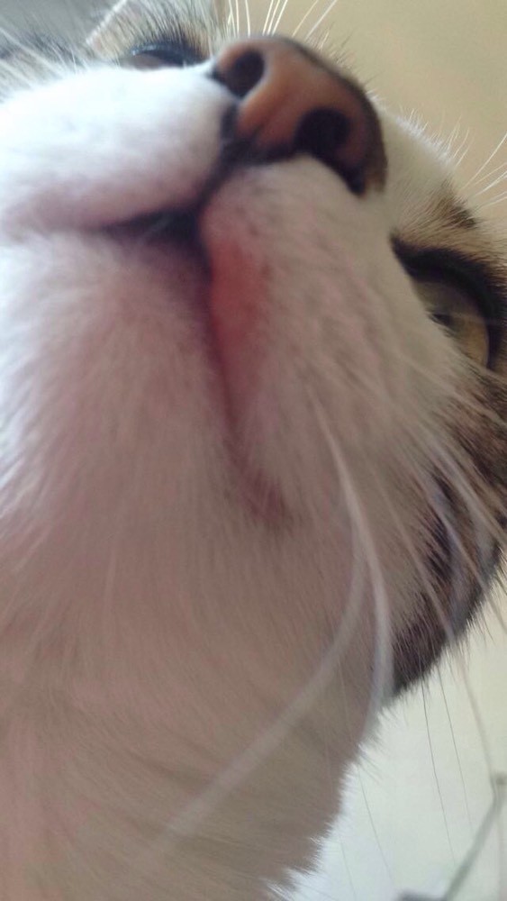 Levres Superieur Gonfle Levres Superieur Gonfle