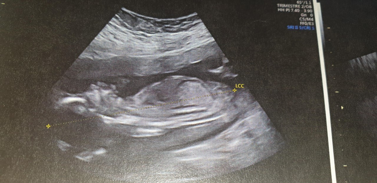 Fille Ou Garcon S Il Vous Plait Grossesse Forum Grossesse Amp Bebe Doctissimo Fille Ou Garcon S Il Vous Plait Grossesse Forum Grossesse Amp Bebe Doctissimo