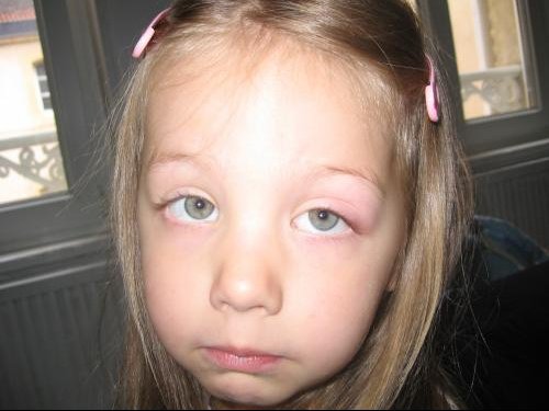 Oeil De Lisa A Votre Avis C Est Quoi Bebe Grandit Forum Grossesse Amp Bebe Doctissimo Oeil De Lisa A Votre Avis C Est Quoi Bebe Grandit Forum Grossesse Amp Bebe Doctissimo