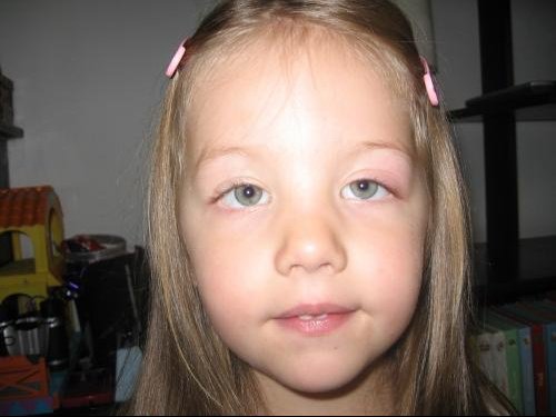 Oeil De Lisa A Votre Avis C Est Quoi Bebe Grandit Forum Grossesse Amp Bebe Doctissimo Oeil De Lisa A Votre Avis C Est Quoi Bebe Grandit Forum Grossesse Amp Bebe Doctissimo