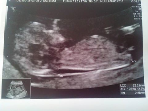 Clarte Nucale 12sa 3 Clarte Nucale 12sa 3