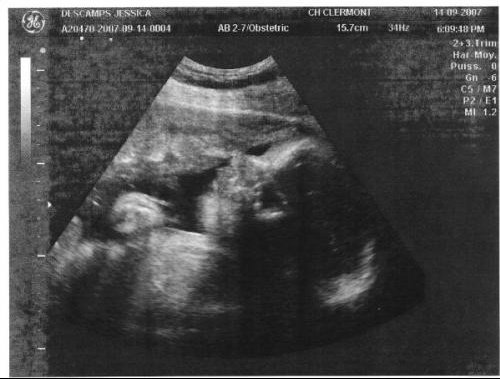 Quel Poids De Votre Bebe A 29sa Svp Grossesse Forum Grossesse Amp Bebe Doctissimo Quel Poids De Votre Bebe A 29sa Svp Grossesse Forum Grossesse Amp Bebe Doctissimo