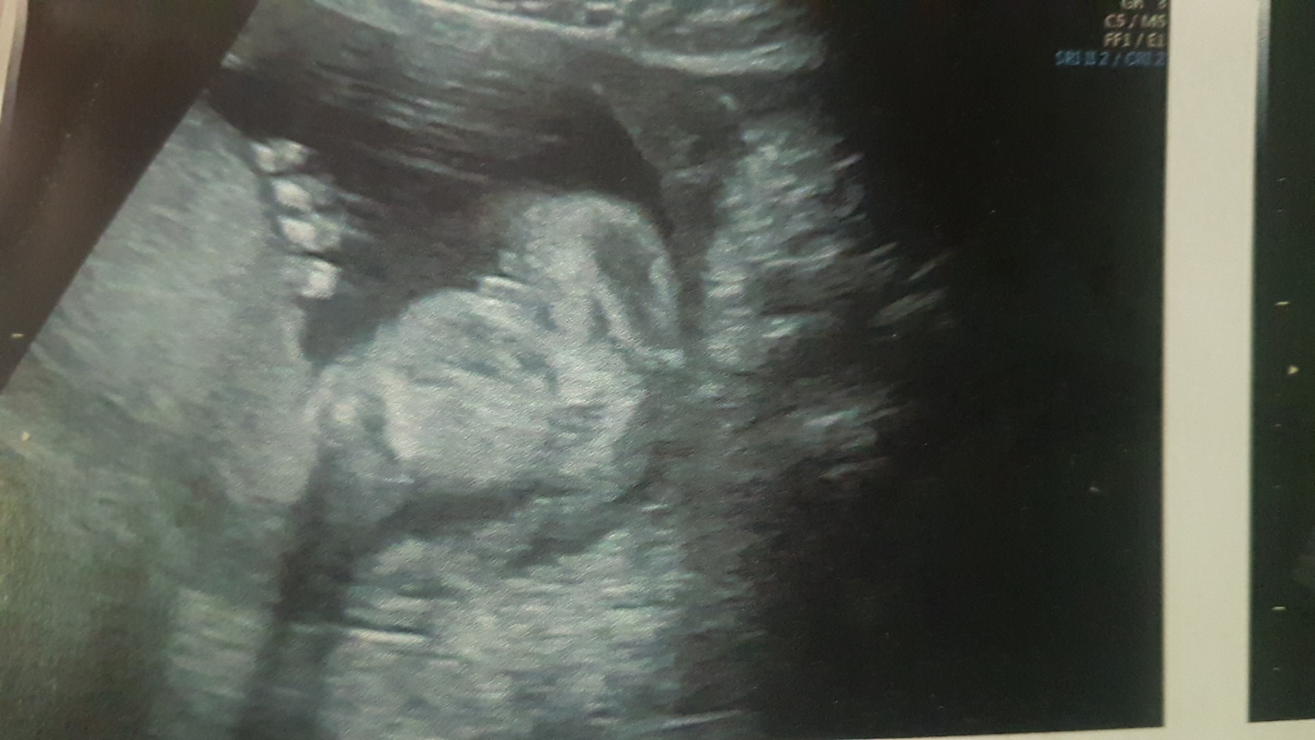 Sexe Bebe Sa 1 Echographie Connaitre Le Sexe De Votre Bebe Forum Grossesse Amp Bebe Doctissimo