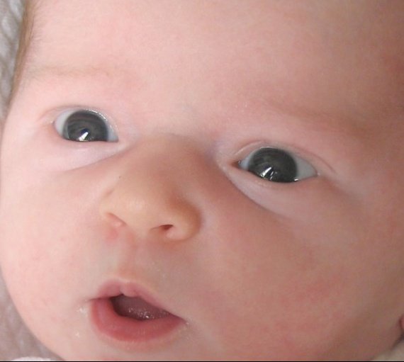 Couleur Des Yeux De Perplexite Couleur Des Yeux De Perplexite