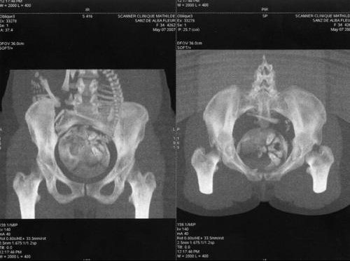 Qui A Passer Un Scanner Du Bassin Futures Mamans Forum Grossesse Amp Bebe Doctissimo Qui A Passer Un Scanner Du Bassin Futures Mamans Forum Grossesse Amp Bebe Doctissimo