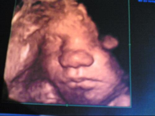 Post A Photo Des Echo Du Troisieme Trimestre Venez Ici Futures Mamans Forum Grossesse Amp Bebe Doctissimo Post A Photo Des Echo Du Troisieme Trimestre Venez Ici Futures Mamans Forum Grossesse Amp Bebe Doctissimo