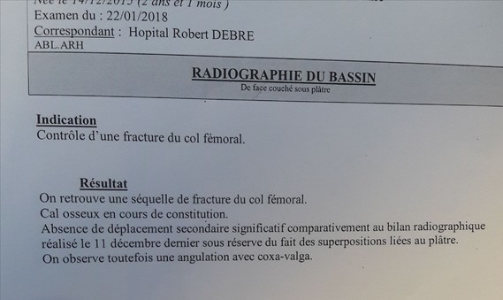Quoi comprendre de ce compte rendu de radio