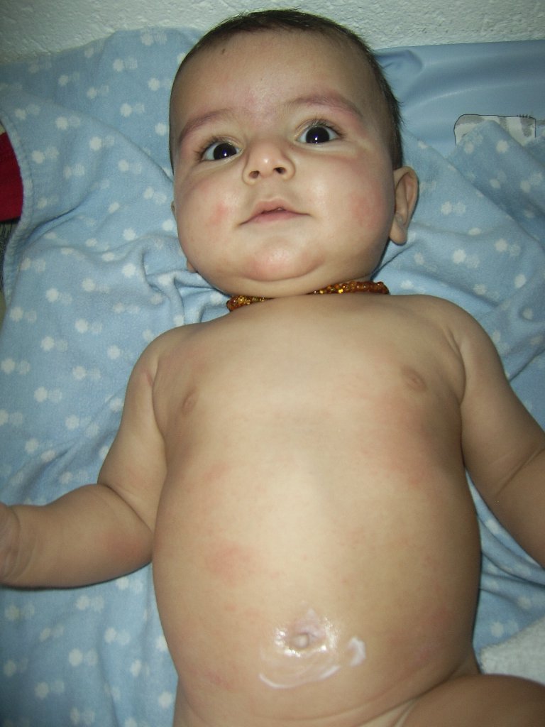 Telechargement Populaire Bebe Bout Du Zizi Rouge Bebe Bout Du Zizi Rouge Fonddecranbly Telechargement Populaire Bebe Bout Du Zizi Rouge Bebe Bout Du Zizi Rouge Fonddecranbly