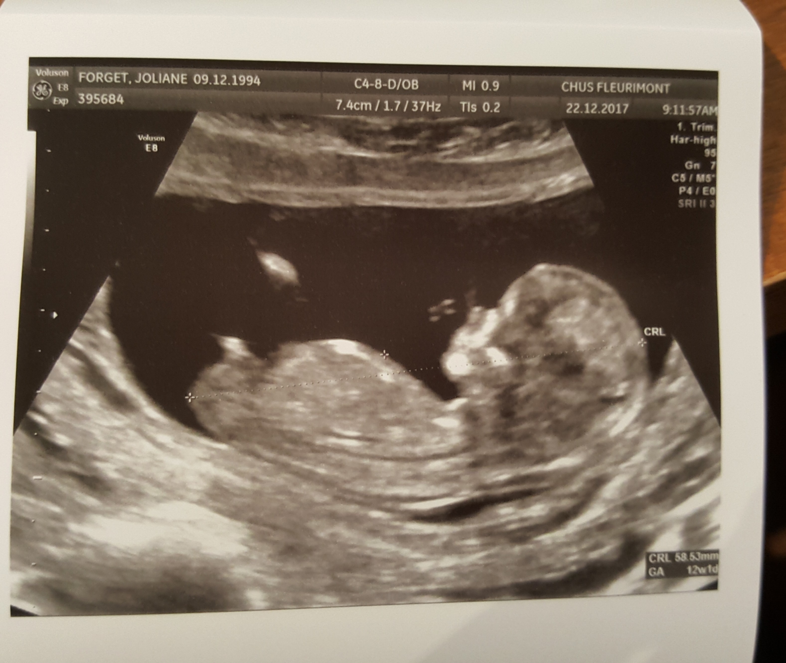 Téléchargement gratuit Images Garcon Echographie Forum Grossesse Bebe le plus cool par