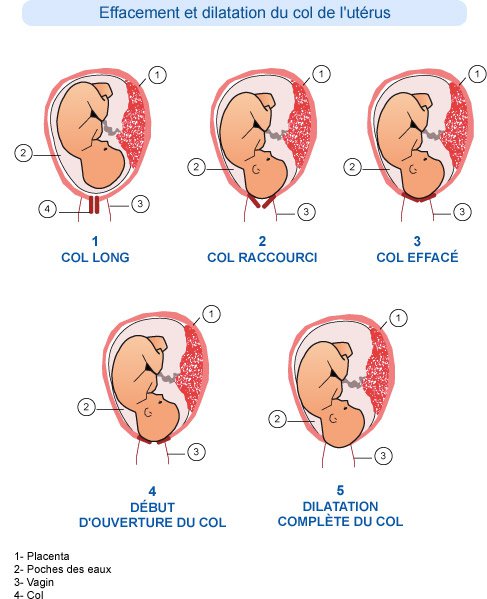 Derniere Ligne Droite Ou En Sont Nos Cols Futures Mamans Forum Grossesse Amp Bebe Doctissimo