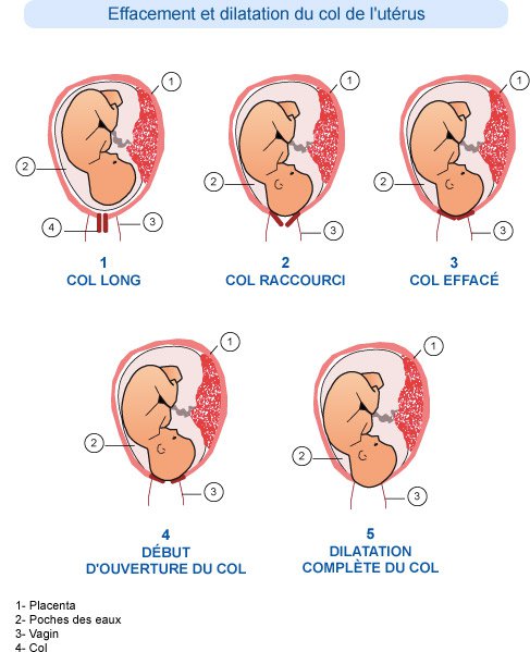 Derniere Ligne Droite Ou En Sont Nos Cols Futures Mamans Forum Grossesse Amp Bebe Doctissimo Derniere Ligne Droite Ou En Sont Nos Cols Futures Mamans Forum Grossesse Amp Bebe Doctissimo
