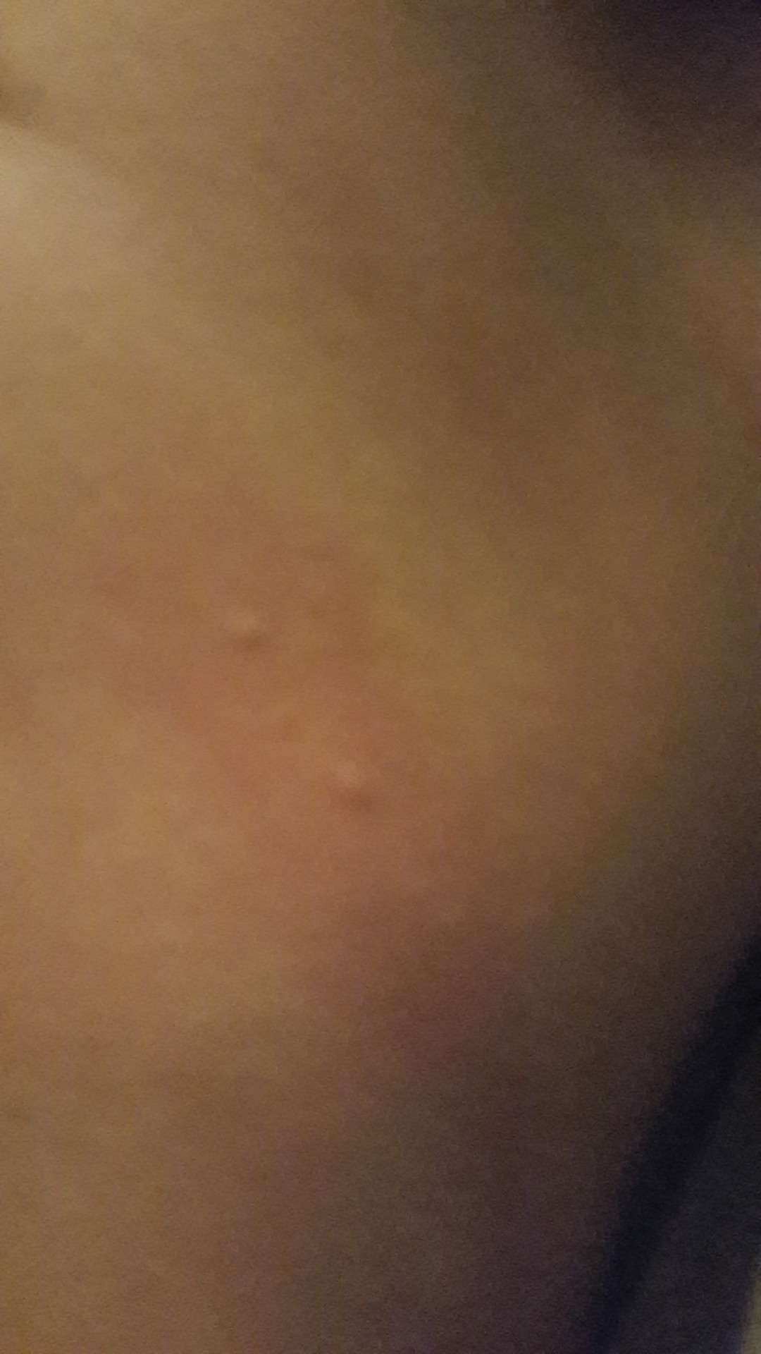 Probleme De Parasite Invisible A L Oeil Nu Forum Libre Sante