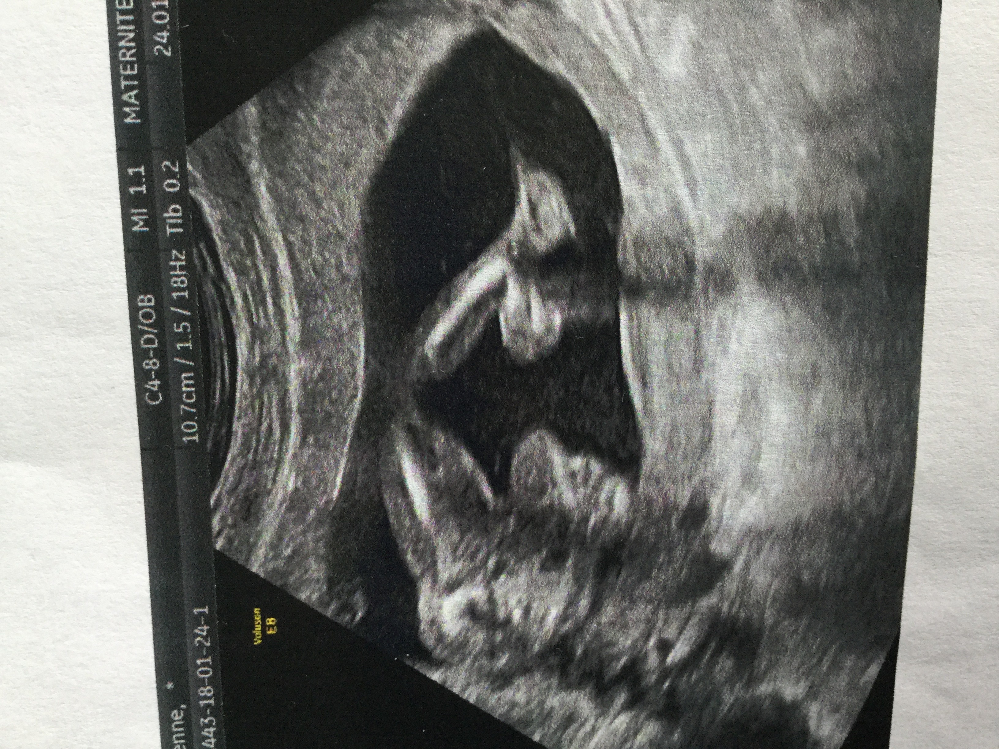 Echographie 17 Sa Sexe Echographie Connaitre Le Sexe De Votre Bebe Forum Grossesse Amp Bebe Doctissimo Echographie 17 Sa Sexe Echographie Connaitre Le Sexe De Votre Bebe Forum Grossesse Amp Bebe Doctissimo