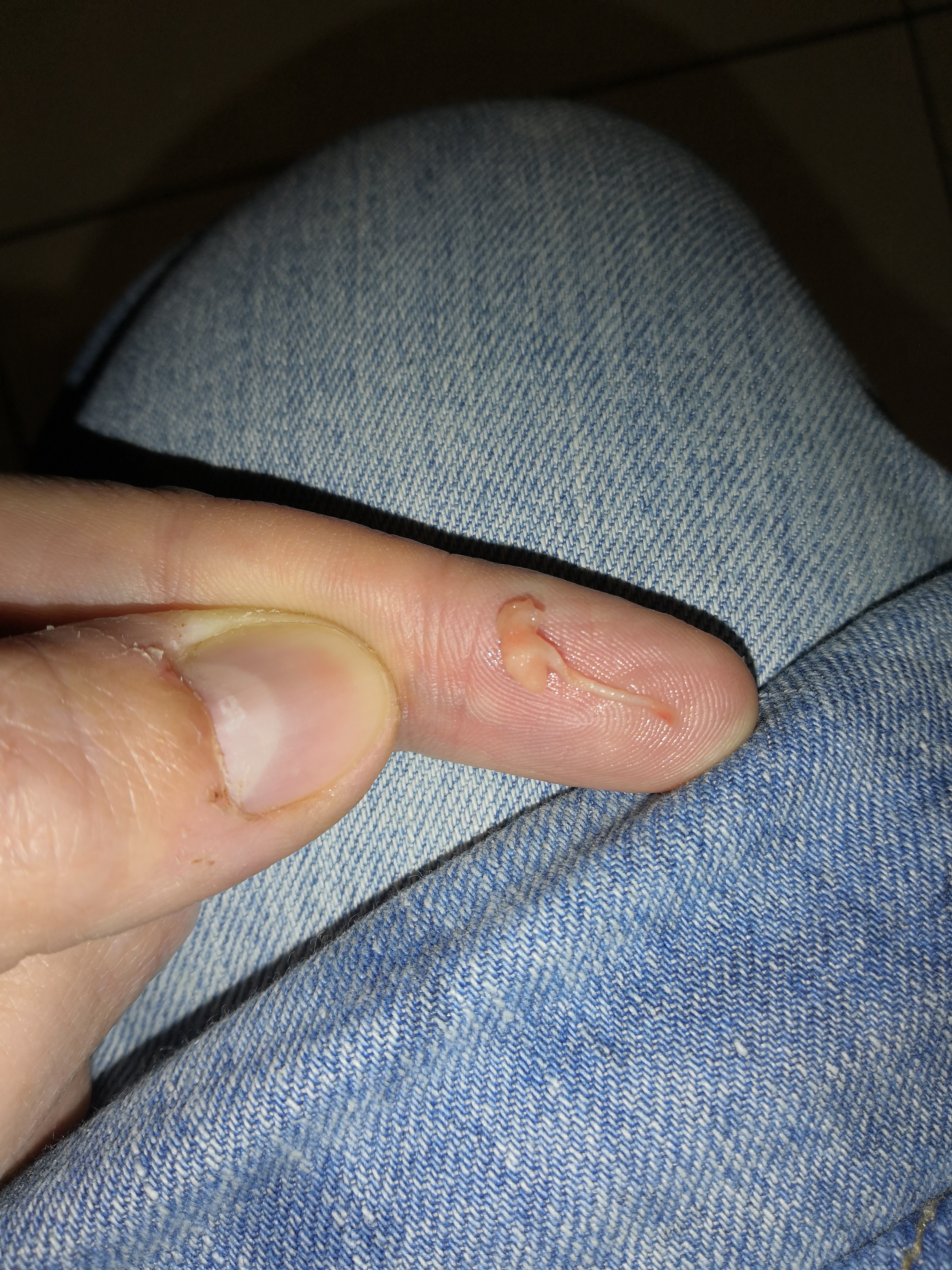 Fausse Couche Precoce Fausse Couche Forum Grossesse Amp Bebe Doctissimo Fausse Couche Precoce Fausse Couche Forum Grossesse Amp Bebe Doctissimo