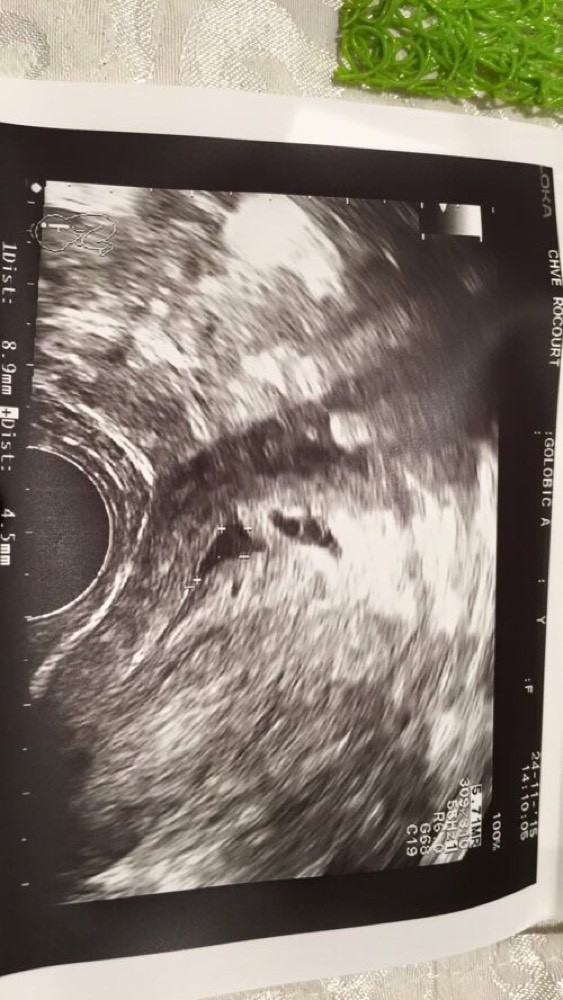 Echographie 3 Semaines De Grossesse Besoin D Avis Echographie Connaitre Le Sexe De Votre Bebe Forum Grossesse Amp Bebe Doctissimo Echographie 3 Semaines De Grossesse Besoin D Avis Echographie Connaitre Le Sexe De Votre Bebe Forum Grossesse Amp Bebe Doctissimo