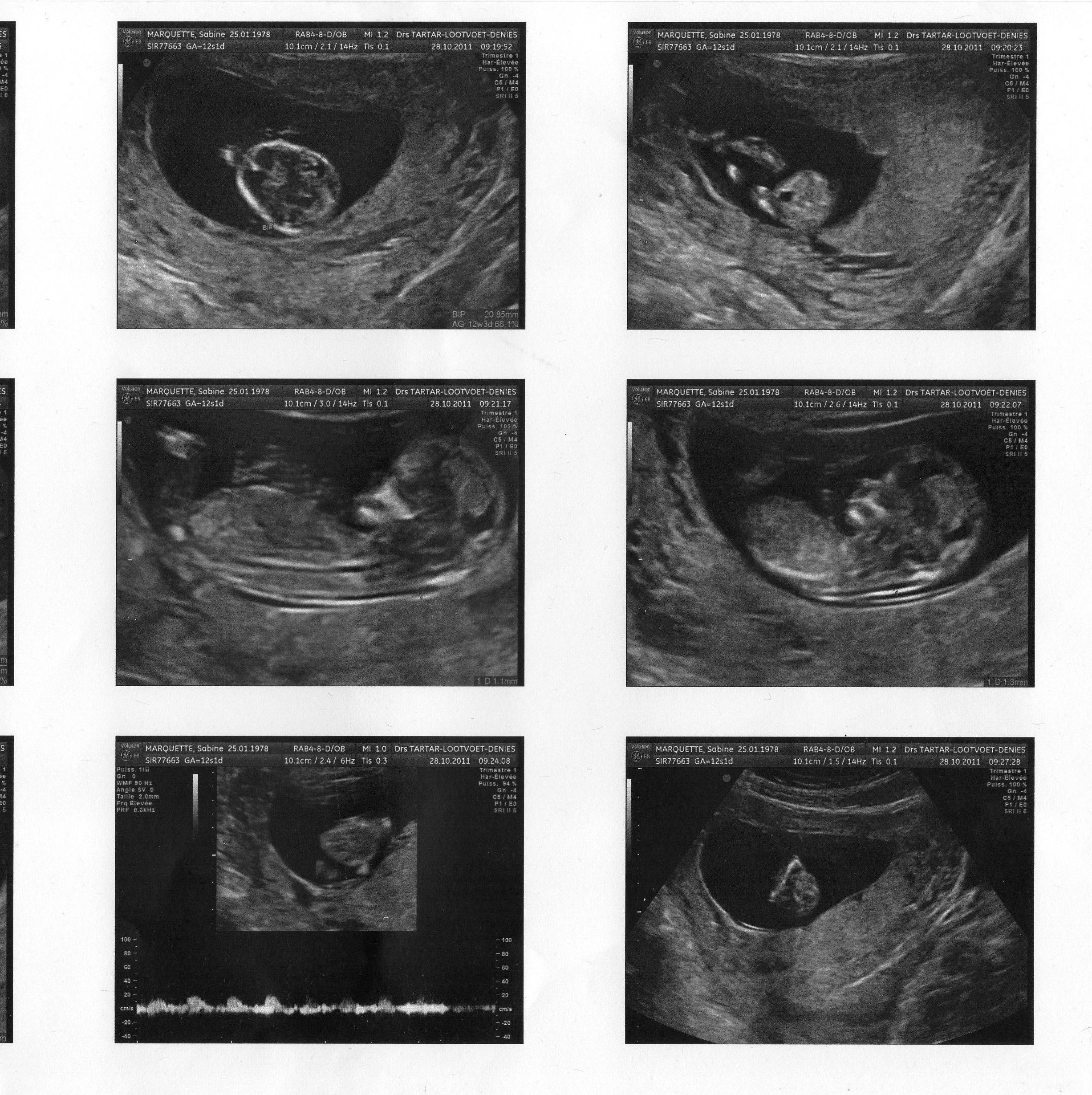 Ou Peut T On Savoir Le Sexe Echographie Connaitre Le Sexe De Votre Bebe Forum Grossesse Amp Bebe Doctissimo Ou Peut T On Savoir Le Sexe Echographie Connaitre Le Sexe De Votre Bebe Forum Grossesse Amp Bebe Doctissimo