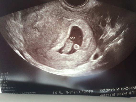 Echo Minitroiz 7sa 5 Fsayx Bebe 3 Fsayx Photos Club Doctissimo Echo Minitroiz 7sa 5 Fsayx Bebe 3 Fsayx Photos Club Doctissimo