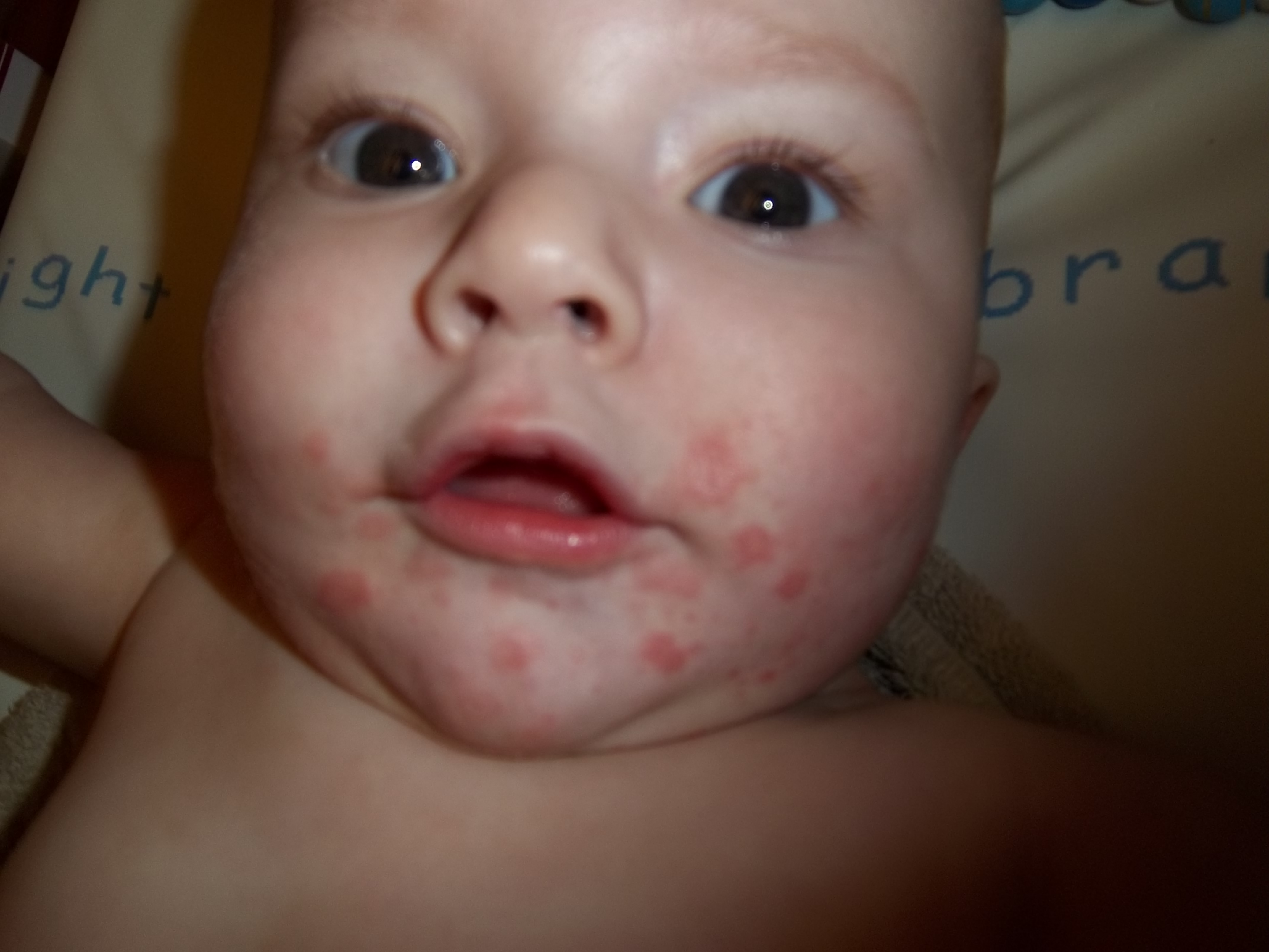 Plaque Sur La Joue Des Idees Bebe Grandit Forum Grossesse Amp Bebe Doctissimo Plaque Sur La Joue Des Idees Bebe Grandit Forum Grossesse Amp Bebe Doctissimo