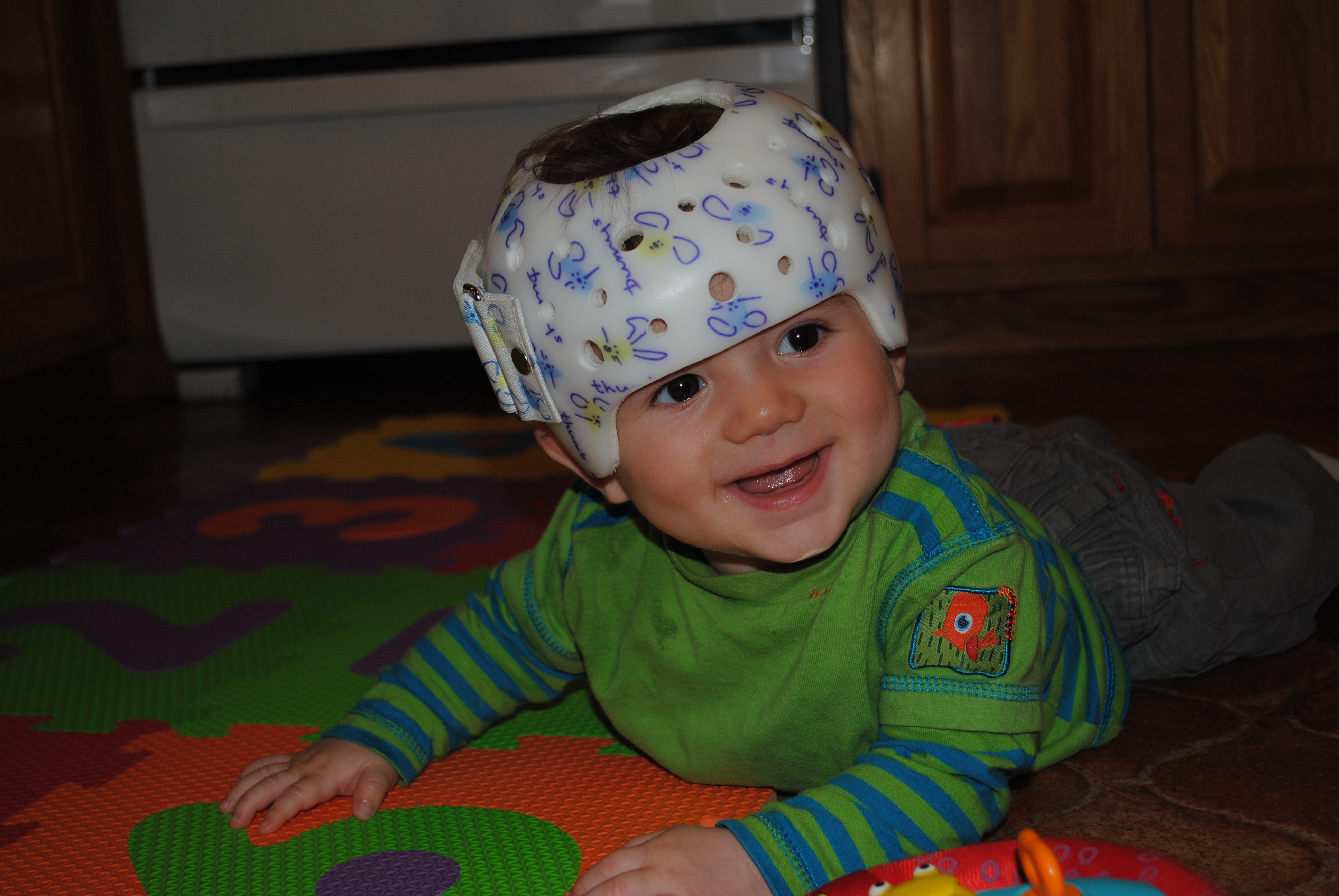 Casque Plagioencephalie Mamans Et Futures Mamans Du Quebec Forum Grossesse Amp Bebe Doctissimo