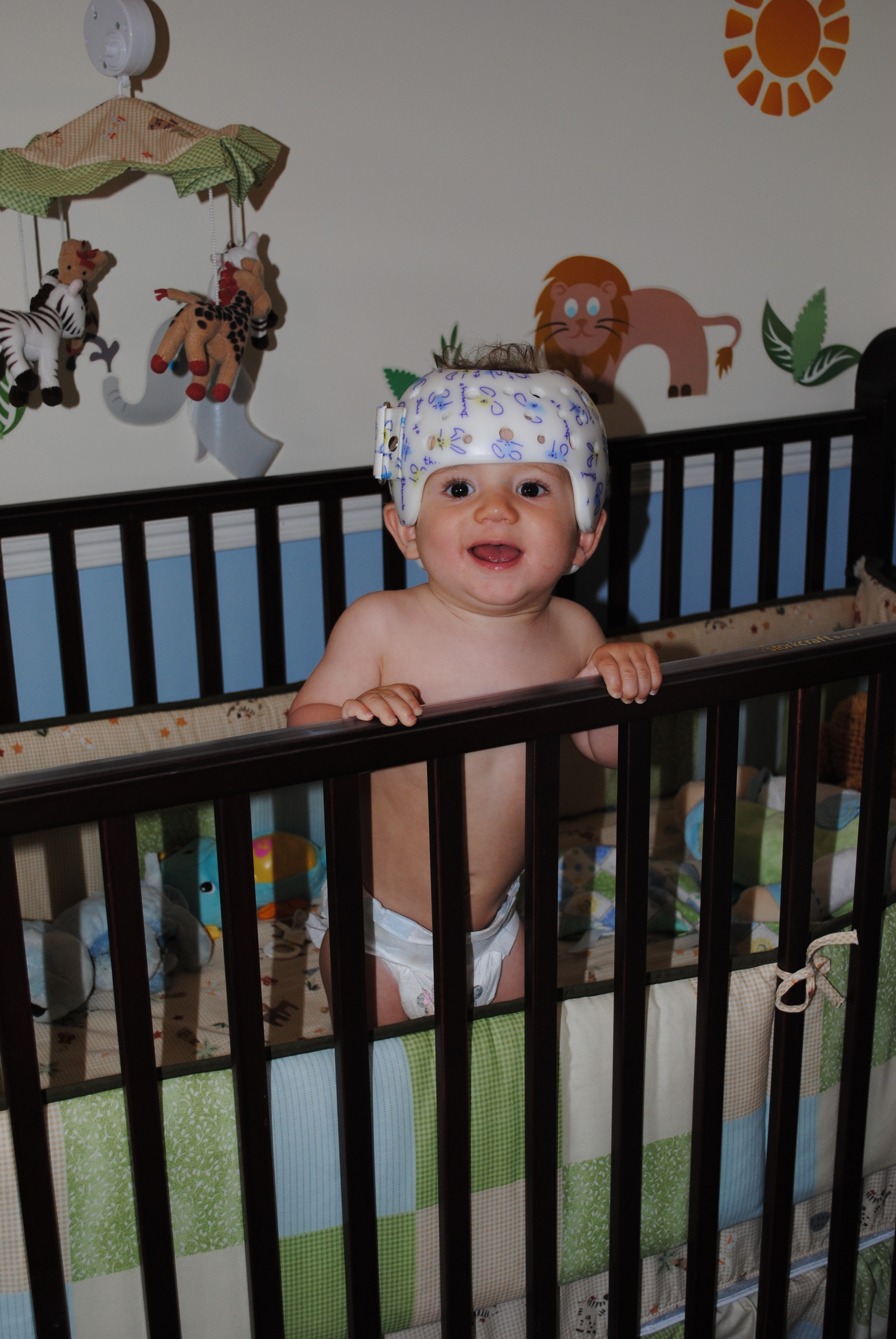 Casque Plagioencephalie Mamans Et Futures Mamans Du Quebec Forum Grossesse Amp Bebe Doctissimo