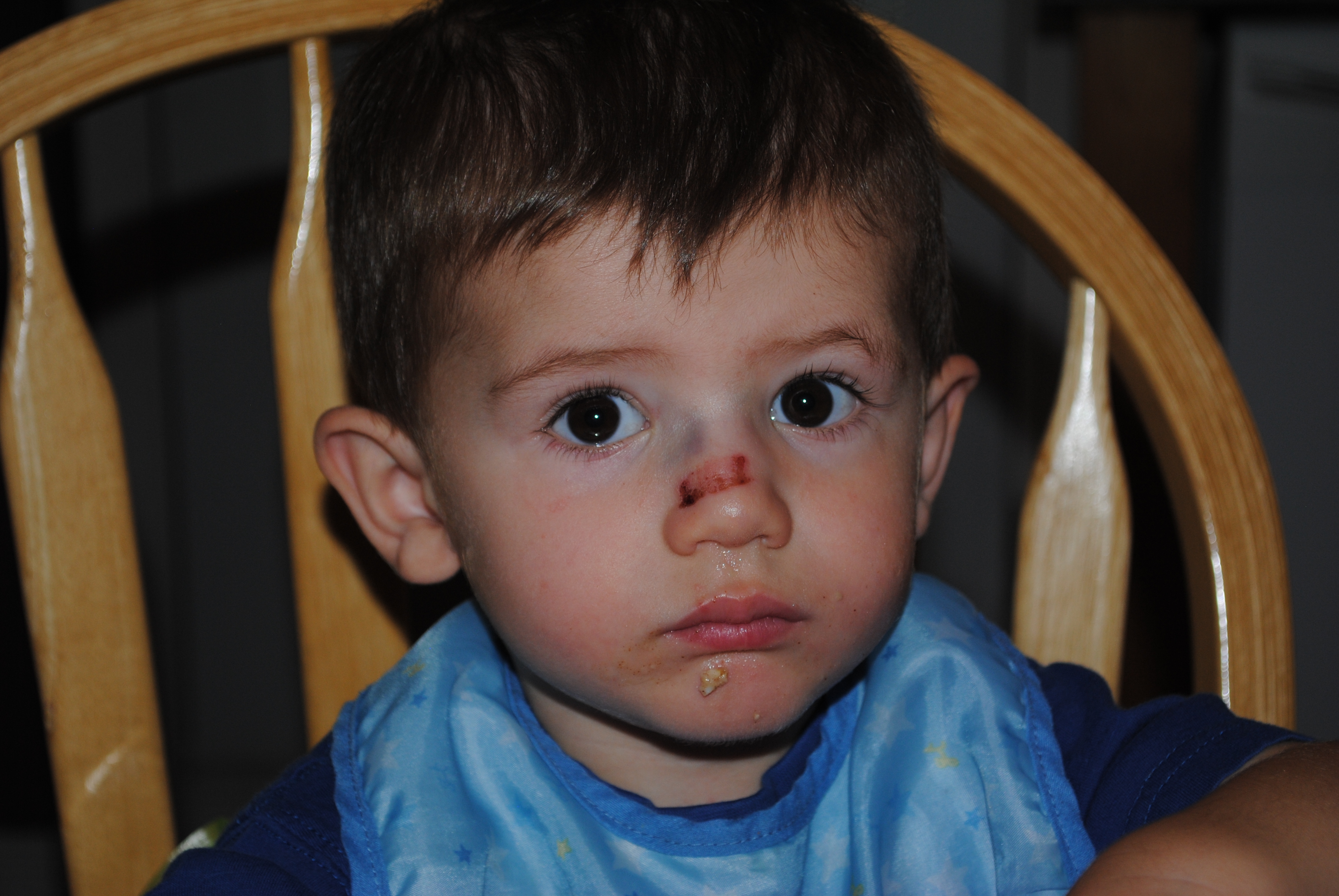 Peut Il S Etre Casse Le Nez Photos Mamans Et Futures Mamans Du Quebec Forum Grossesse Amp Bebe Doctissimo Peut Il S Etre Casse Le Nez Photos Mamans Et Futures Mamans Du Quebec Forum Grossesse Amp Bebe Doctissimo