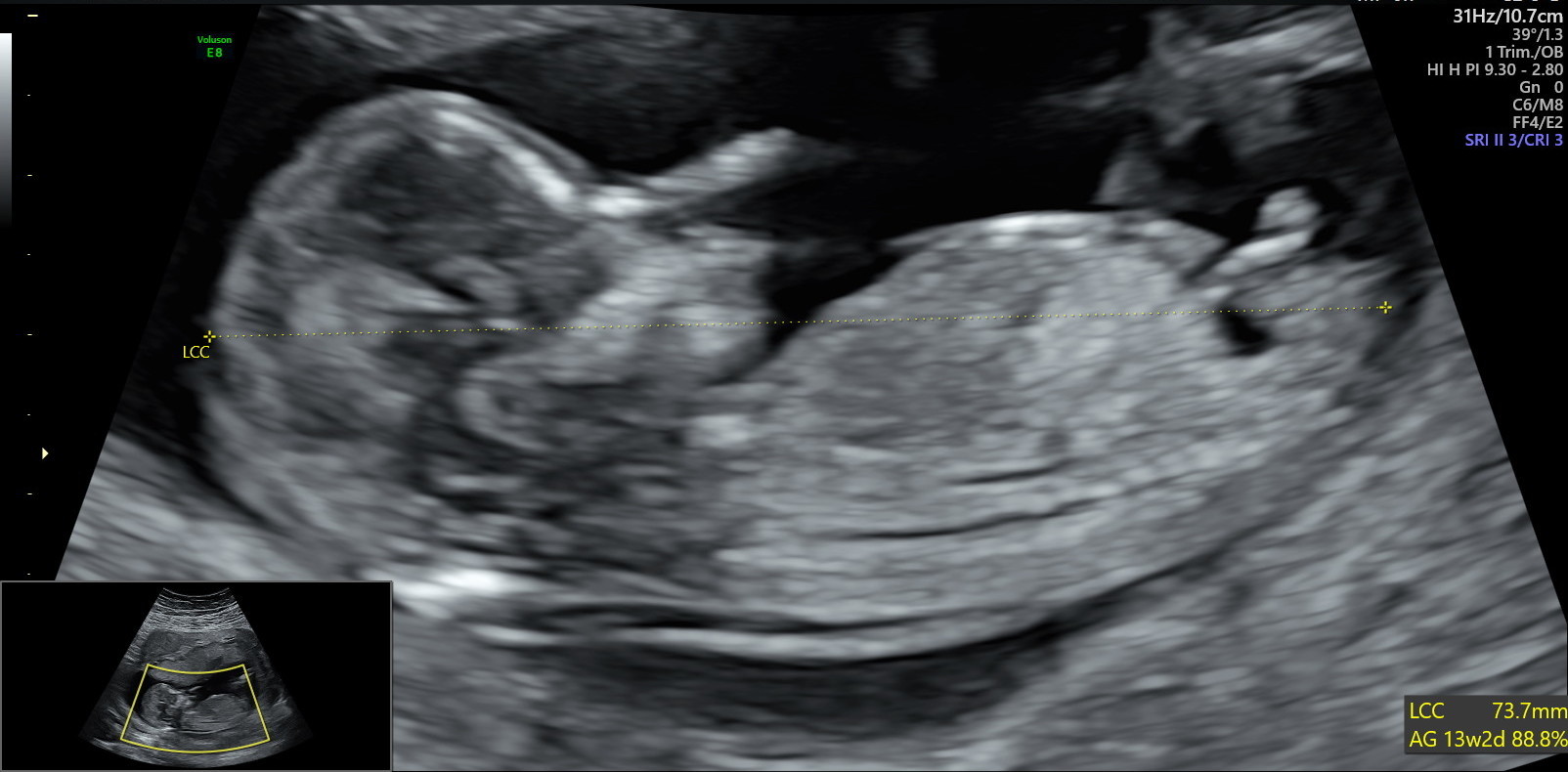 Estimation Sexe Bebe Echographie Connaitre Le Sexe De Votre Bebe Forum Grossesse Amp Bebe Doctissimo Estimation Sexe Bebe Echographie Connaitre Le Sexe De Votre Bebe Forum Grossesse Amp Bebe Doctissimo