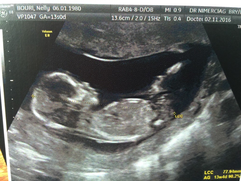 Avis Sex Echo 13 Sa Et 6 Jours Echographie Connaitre Le Sexe De Votre Bebe Forum Grossesse Amp Bebe Doctissimo Avis Sex Echo 13 Sa Et 6 Jours Echographie Connaitre Le Sexe De Votre Bebe Forum Grossesse Amp Bebe Doctissimo