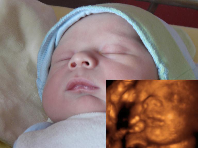 Echo Tendresse Rouen Grossesse Forum Grossesse Amp Bebe Doctissimo Echo Tendresse Rouen Grossesse Forum Grossesse Amp Bebe Doctissimo
