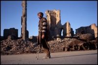 Afghan amputee, victim of a Soviet land mine,Kabul, Afghanistan, 1996