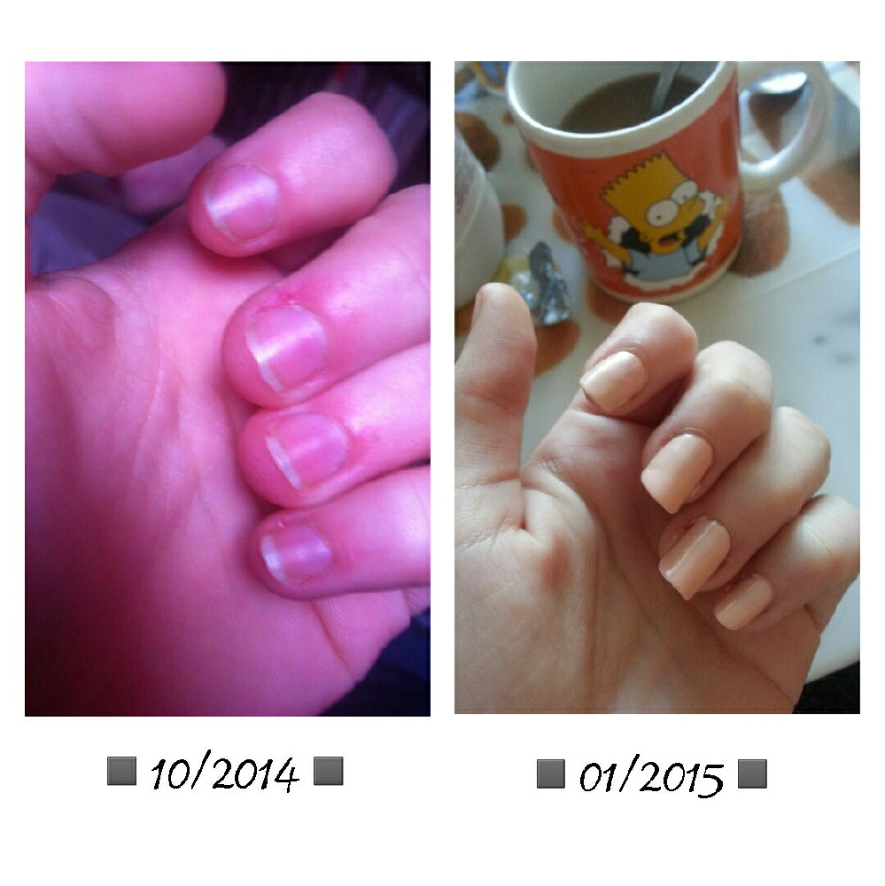 Je Me Ronge Les Ongles Beauté Des Ongles Forum Beauté