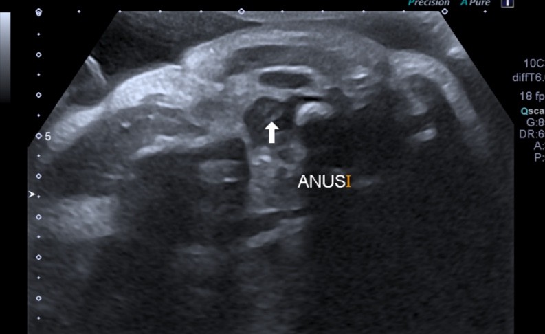Doute Sexe 32sa Echographie Connaitre Le Sexe De Votre Bebe Forum Grossesse Amp Bebe Doctissimo